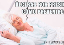 ULCERAS POR PRESION COMO PREVENIRLAS