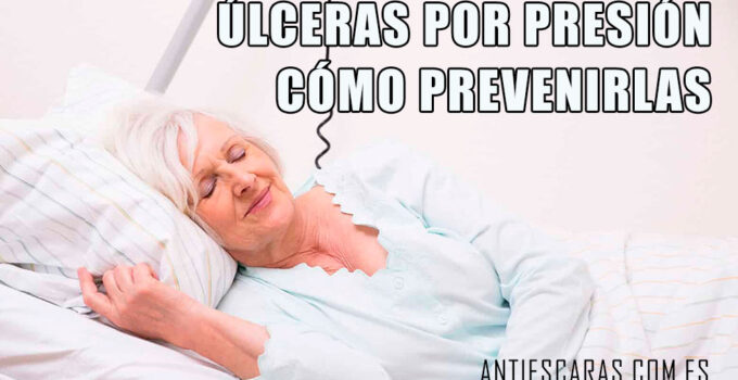 ULCERAS POR PRESION COMO PREVENIRLAS